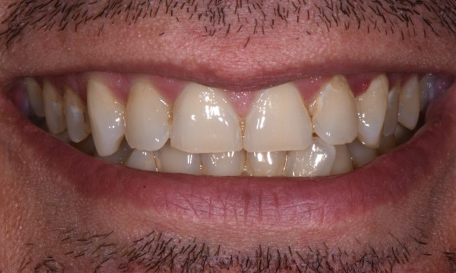CS5 Before