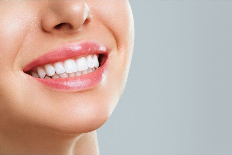 Do You Need Surgery for Dental Veneers? (Answered!)